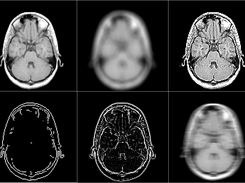 Image Analysis