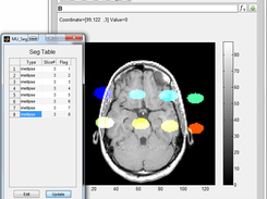 Multi-Slice Segmentation Management