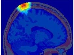 MCX human head simulations