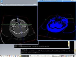 Visualization of volume data and thresholding result.
