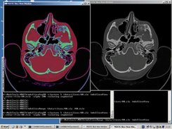 Pixel-based image segmentation using EM algorithm.