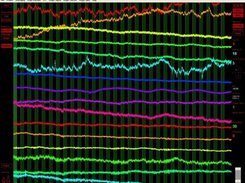 EEG traces (XP)