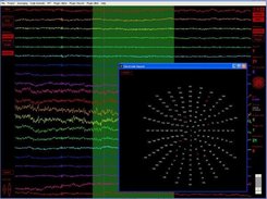 EEG traces with electrode map (XP)