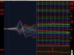 EP and automatic eye blink detection (XP)