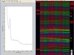 FFT analysis (XP)