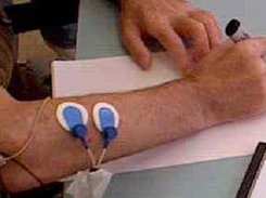 Electrode placement for enhancing the tenodesis grip