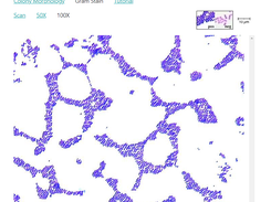 Focusing the Gram stain on the Bacteriology simulator.