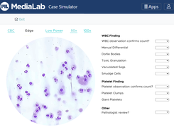 Blood smears through the virtual microscope in the Red Blood Cell Morphology simulator.