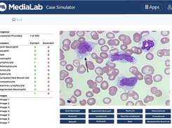 Identifying WBCs in the Advanced White Blood Cell Differential simulator.