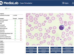 Identifying WBCs in the White Blood Cell Differential simulator.