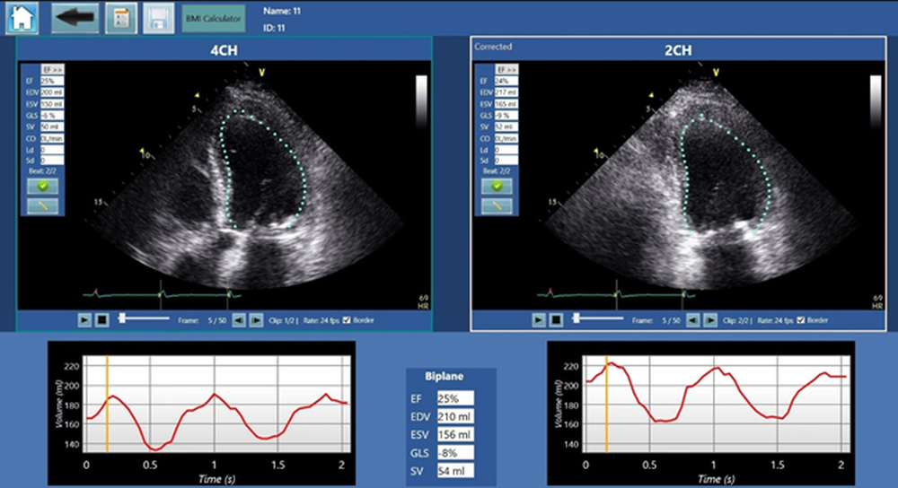 Merlin CardioMotion Screenshot 1
