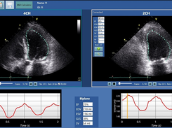 Merlin CardioMotion Screenshot 1