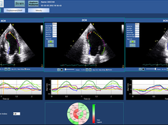 Merlin CardioMotion Screenshot 1