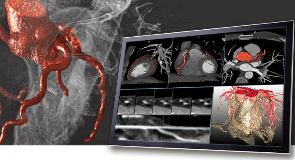 MeVisLab Screenshot 1