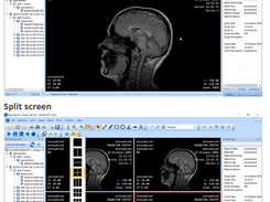 MicroDicom Screenshot 1