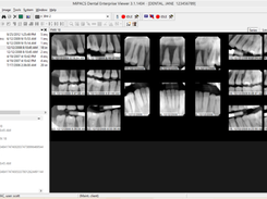 MiPACS Dental Enterprise Viewer Screenshot 1