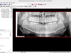 MiPACS Dental Enterprise Viewer Screenshot 1