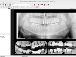 MiPACS Dental Enterprise Viewer Screenshot 1