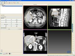 interactive segmentation of volumetric images (MR, CT, US)