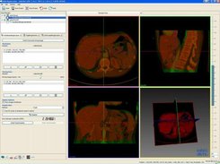 Registration of 2D and 3D images