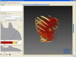 GPU accelerated volume visualization