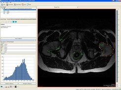 Measurement and image statistics