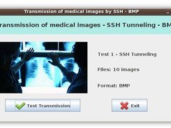 Screen - Transmission of medical images by SSH - BMP