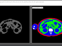 MMMISA Screenshot 2