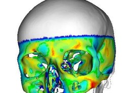 Visualise distances between surface meshes