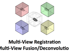 Illustration of a typical multiview acquisition. Four views were acquired in different orientations and need to be reconstructed