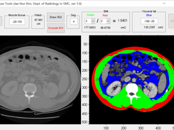 Muscle Fat Area Measurement