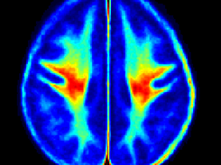 Myelin water atlas Screenshot 1
