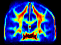 Myelin water atlas Screenshot 2