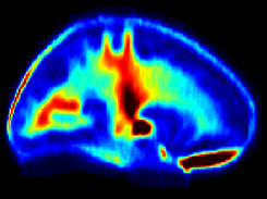 Myelin water atlas Screenshot 3