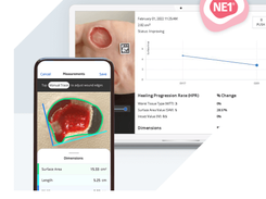 NE1 Wound Management System Screenshot 1