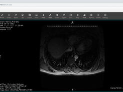 Online DICOM Viewer