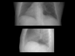 X-ray simulation with NiftyRec