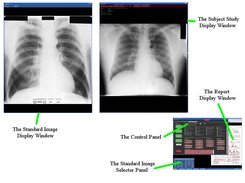 BViewer Screen Layout
