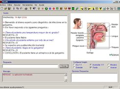 Figura 5.- NIVEL9 Finaliza sesión de SE  para diagnóstico médico