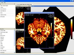 Nukak3D Medical Image Viewer, DICOM Support