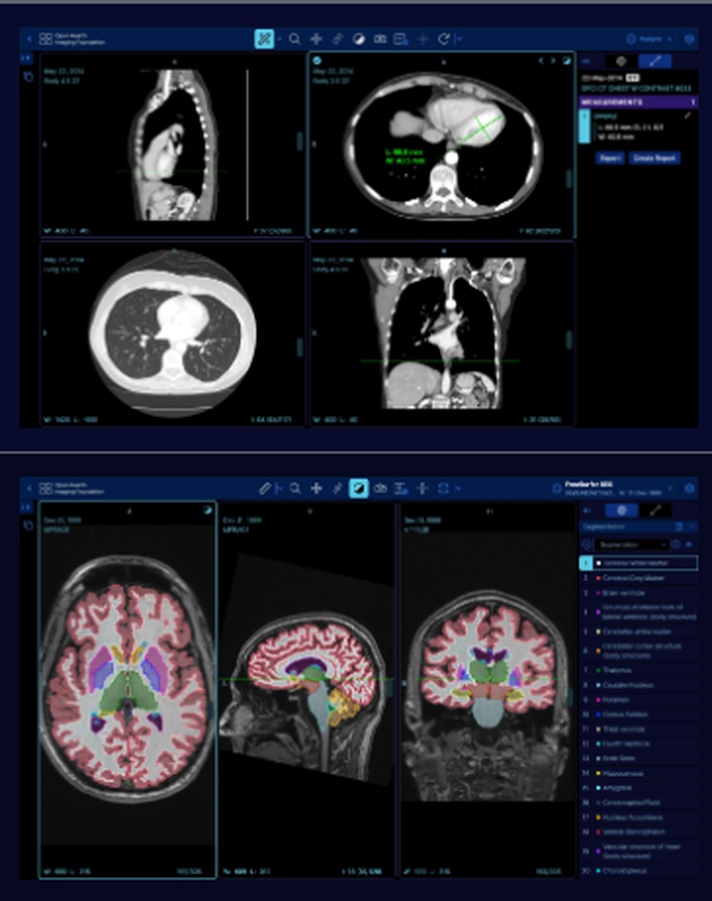OHIF Viewer Screenshot 1