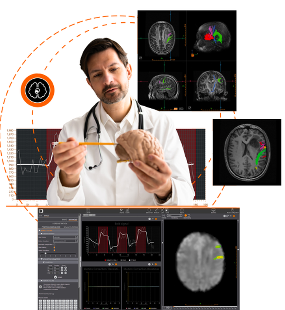 Olea Medical fMRI Screenshot 1