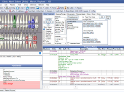 Open Dental Chart Module