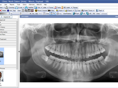 Open Dental Imaging Module