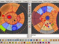 Fundus schema with any values