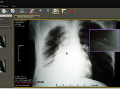 Ferramenta OpenSource Integrada ao OpenCTI para visualização de Imagens