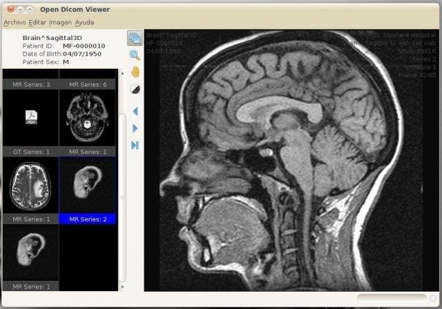 download the last version for iphoneLim DICOM Viewer