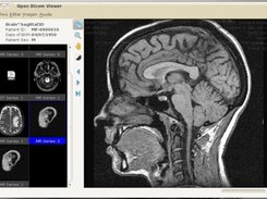 Free dicom viewer for mac os