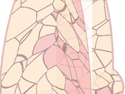 Penn XPL Software Breast Phantom