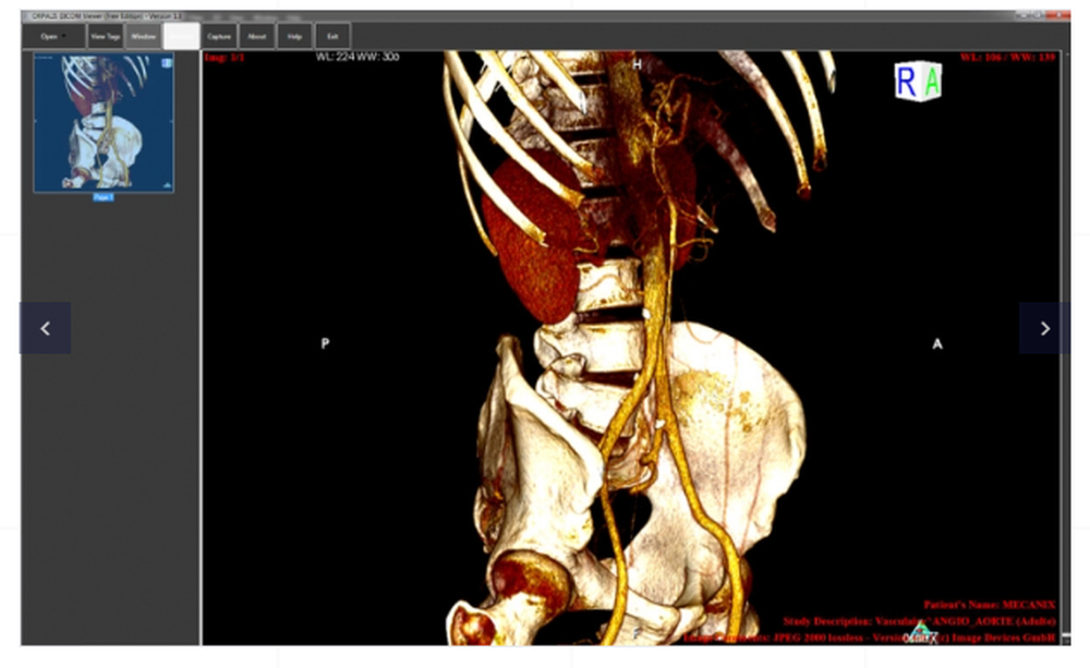 ORPALIS DICOM Viewer Screenshot 1